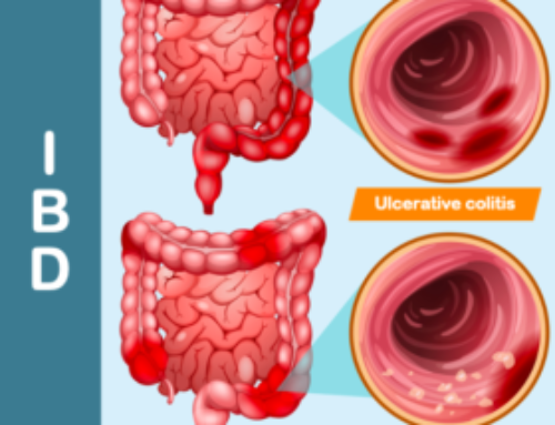 Probiotiques et maladies inflammatoires chroniques de l’intestin (MICI)