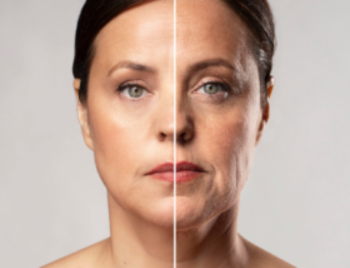 Skin: the appearance of wrinkles may be linked to skin microbiota